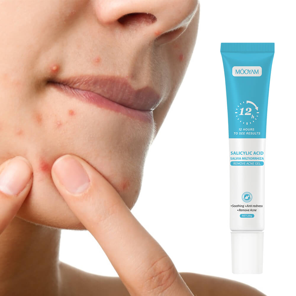 აკნეს მალამო - მუიამი - Image 2