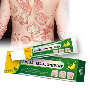 ფსორიაზის მალამო - დონგიტენგი